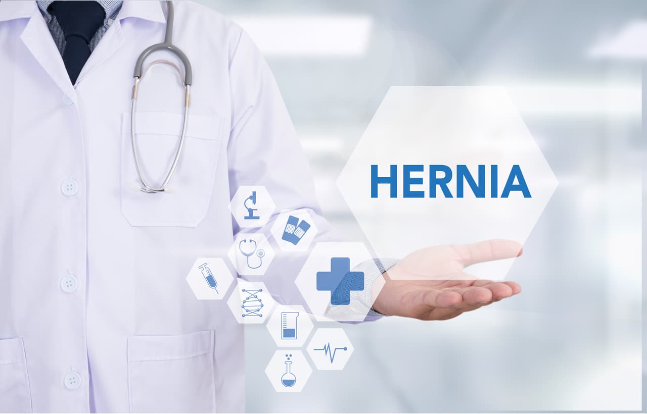 Hernia Mesh Lawsuit Latest Settlements & Updates 2023